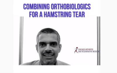 Combining Orthobiologic Treatments for a Hamstring tear