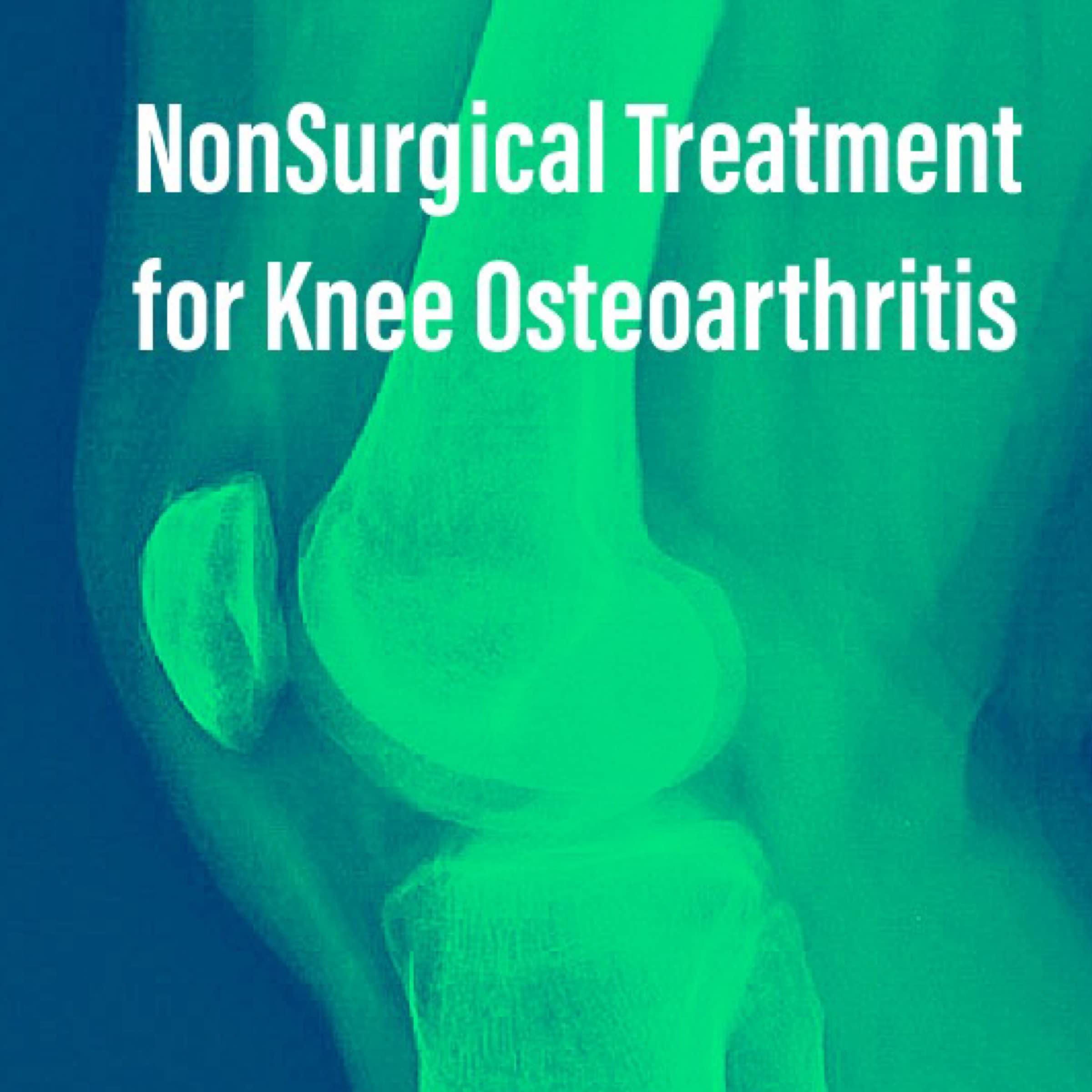 Non Surgical Treatment Options for Knee Osteoarthritis