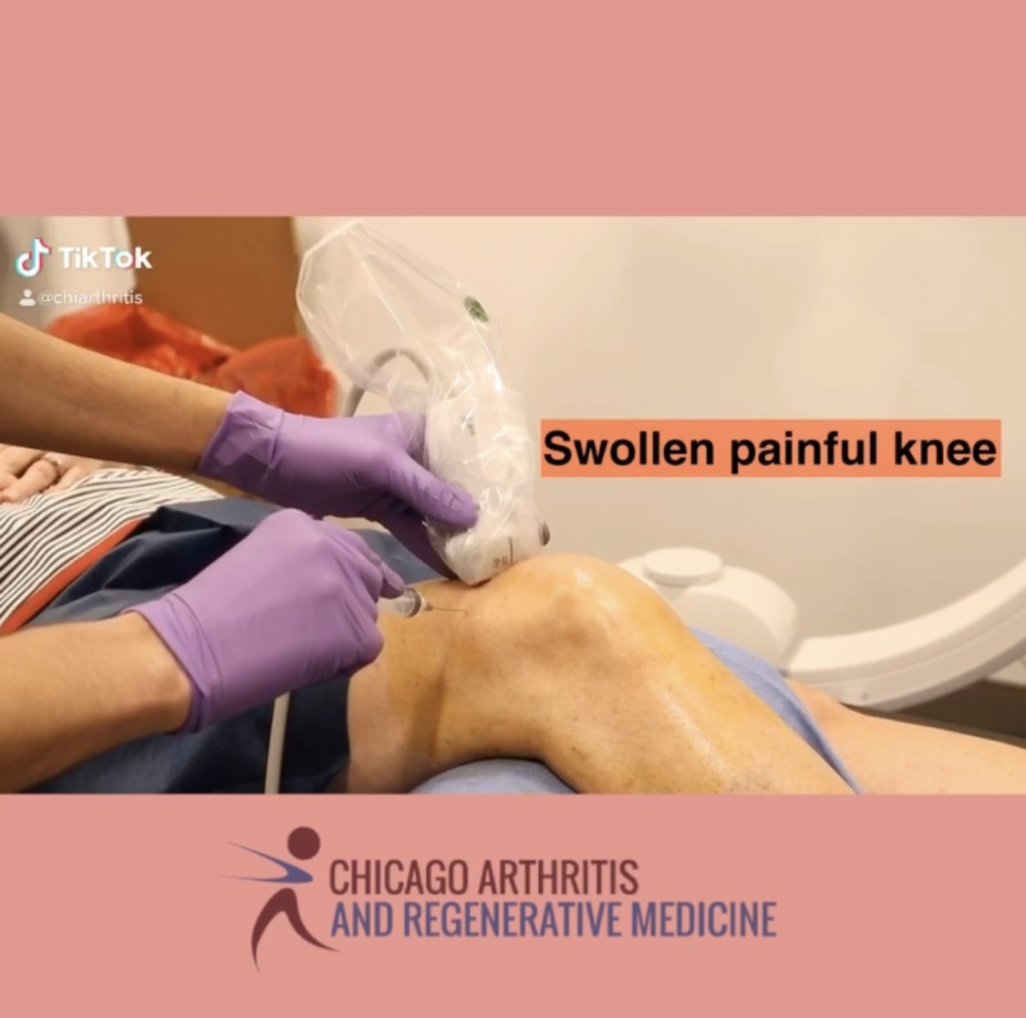 How to treat a Painful Swollen Knee