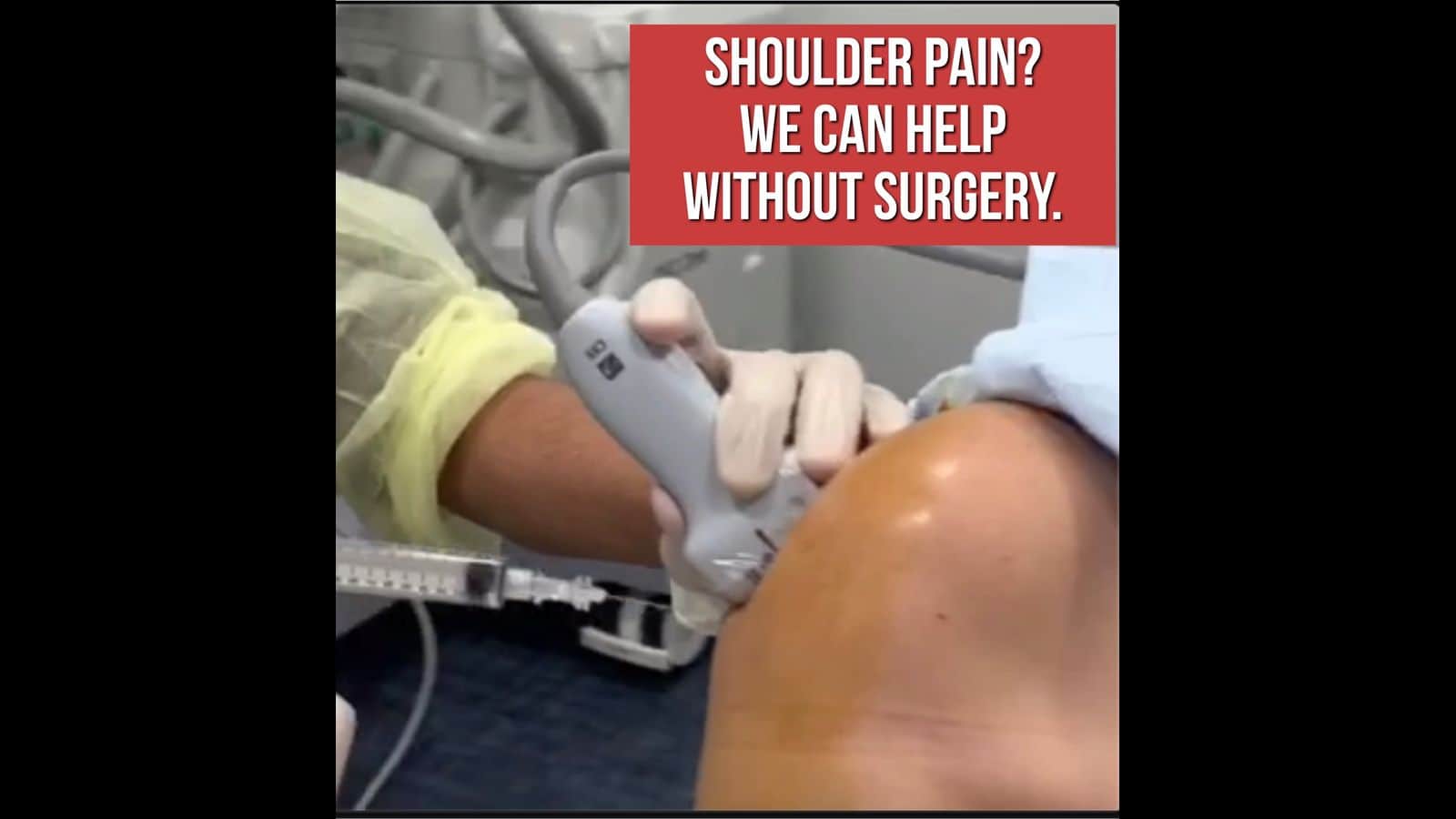 Shoulder Pain- Nerve block