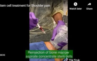 Injection Video- Stem cell treatment for Shoulder pain