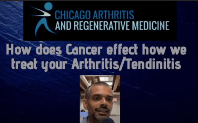 How does Cancer effect how we treat your Arthritis and Tendinitis