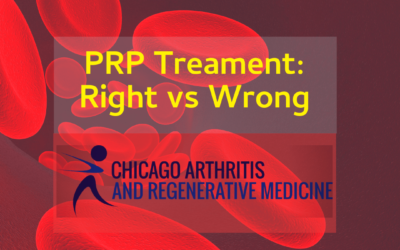 PRP Treatment- Right versus Wrong