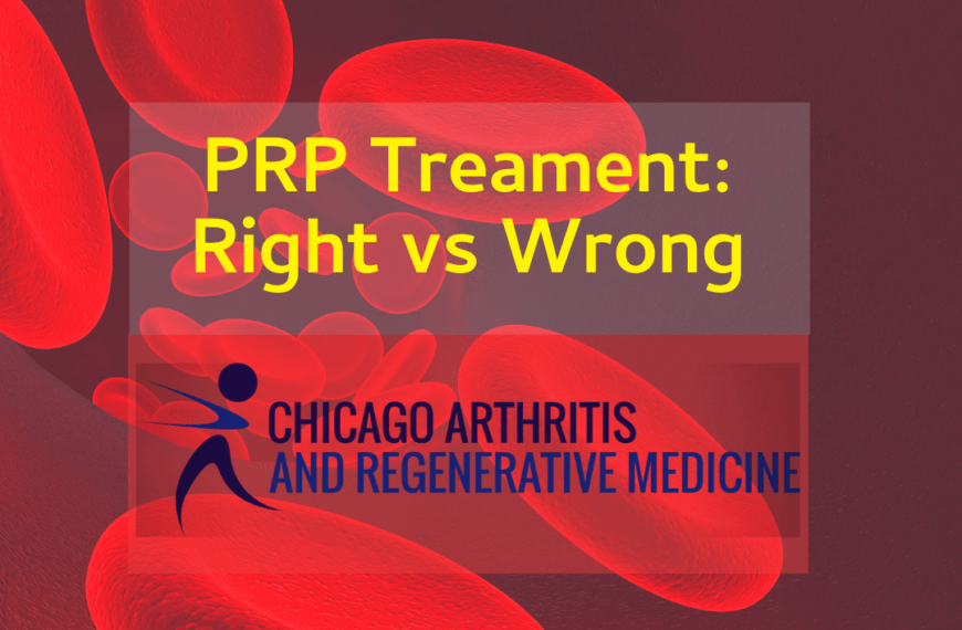 PRP Treatment- Right versus Wrong