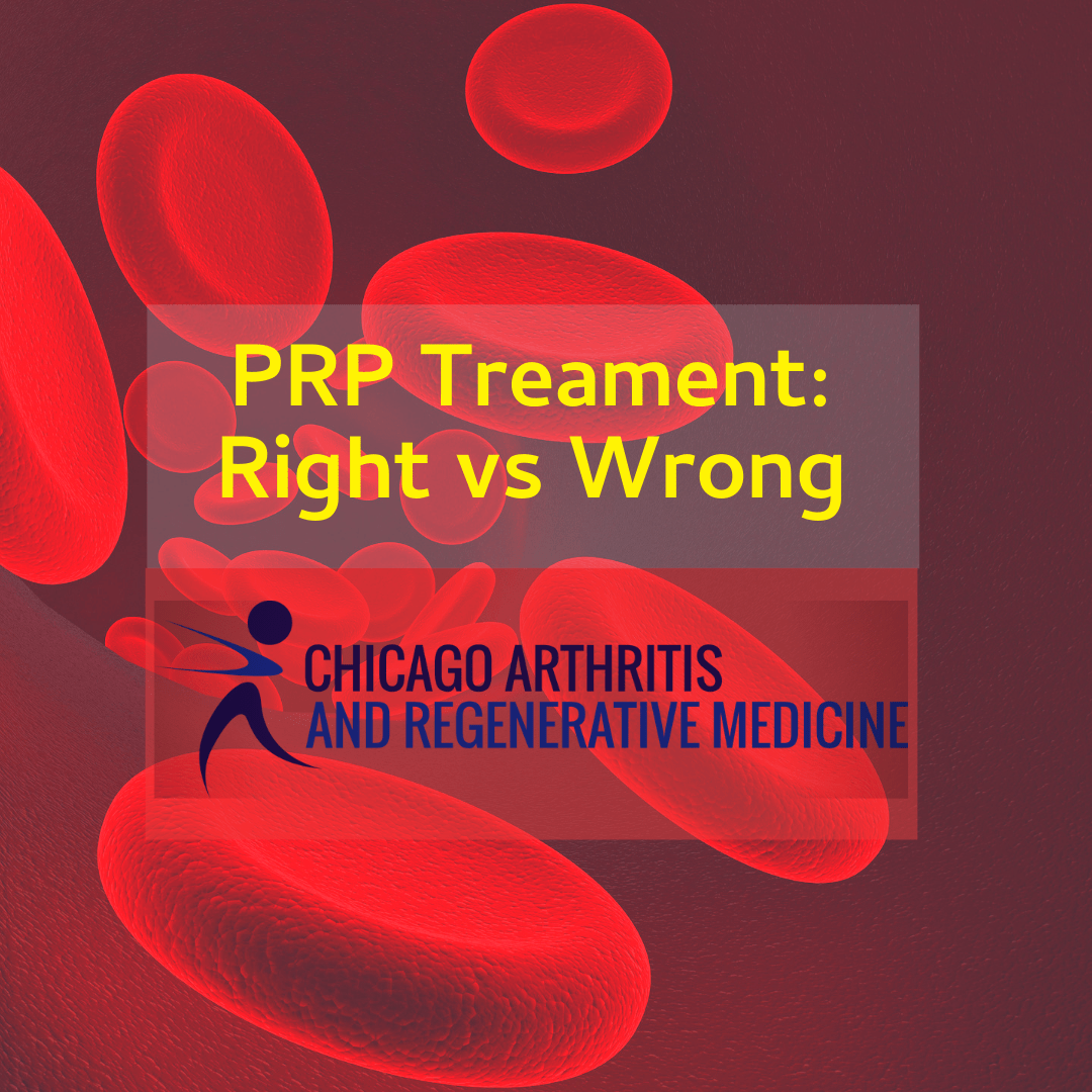 the right way to do prp treatment