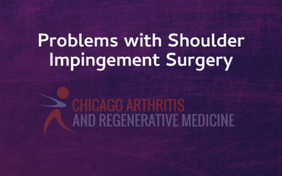 Issues with Shoulder Impingement Surgery