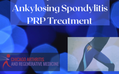 Ankylosing Spondylitis, Hip Pain, PRP treatment