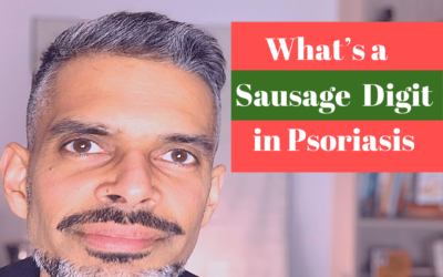 Sausage Digit in Psoriasis