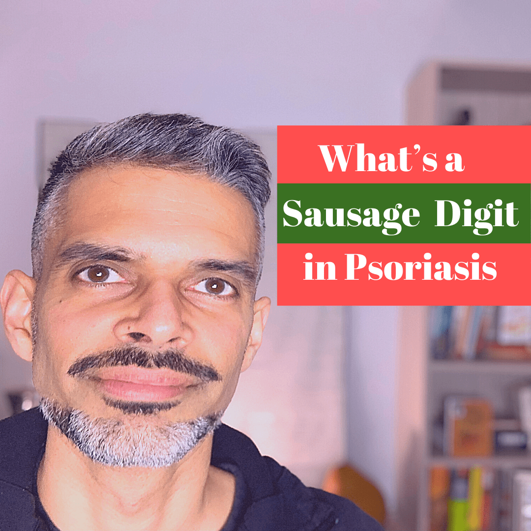 Sausage Digit in Psoriasis