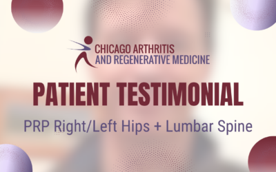 Craig’s PRP Treatment for Right/Left Hips + Lumbar Spine | Chicago Arthritis Testimonial