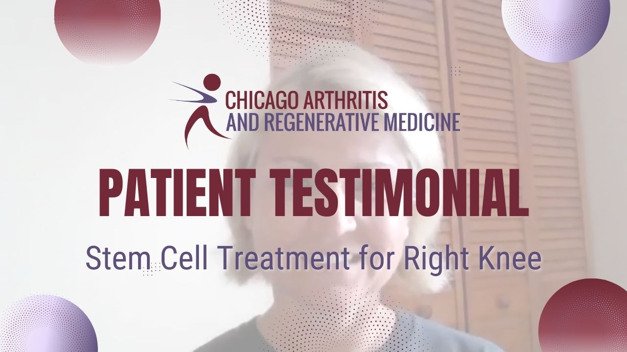 Patty’s Stem Cell Treatment for Right Knee | Chicago Arthritis Testimonial