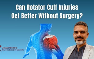 Can Rotator Cuff Injuries Get Better Without Surgery?