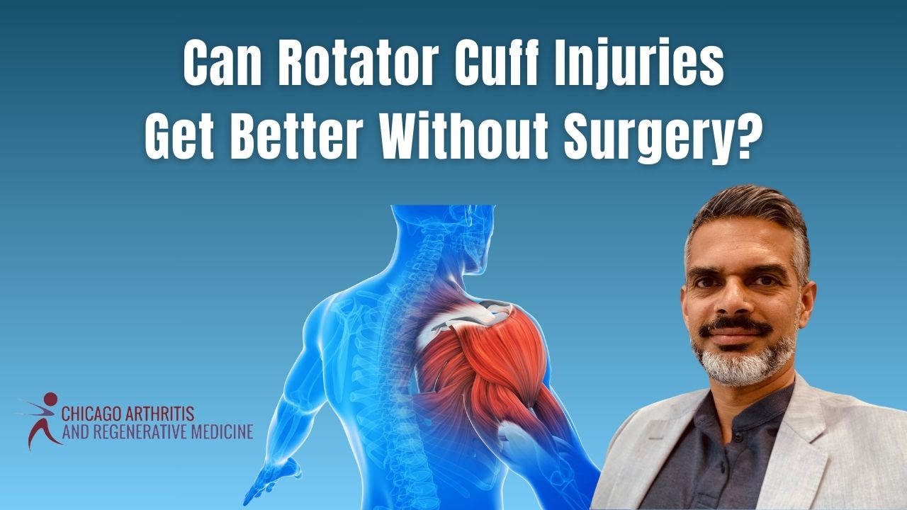 Can Rotator Cuff Injuries Get Better Without Surgery?