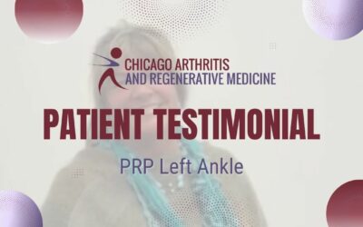 JoAnn’s PRP Treatment for Left Ankle | Chicago Arthritis Testimonial