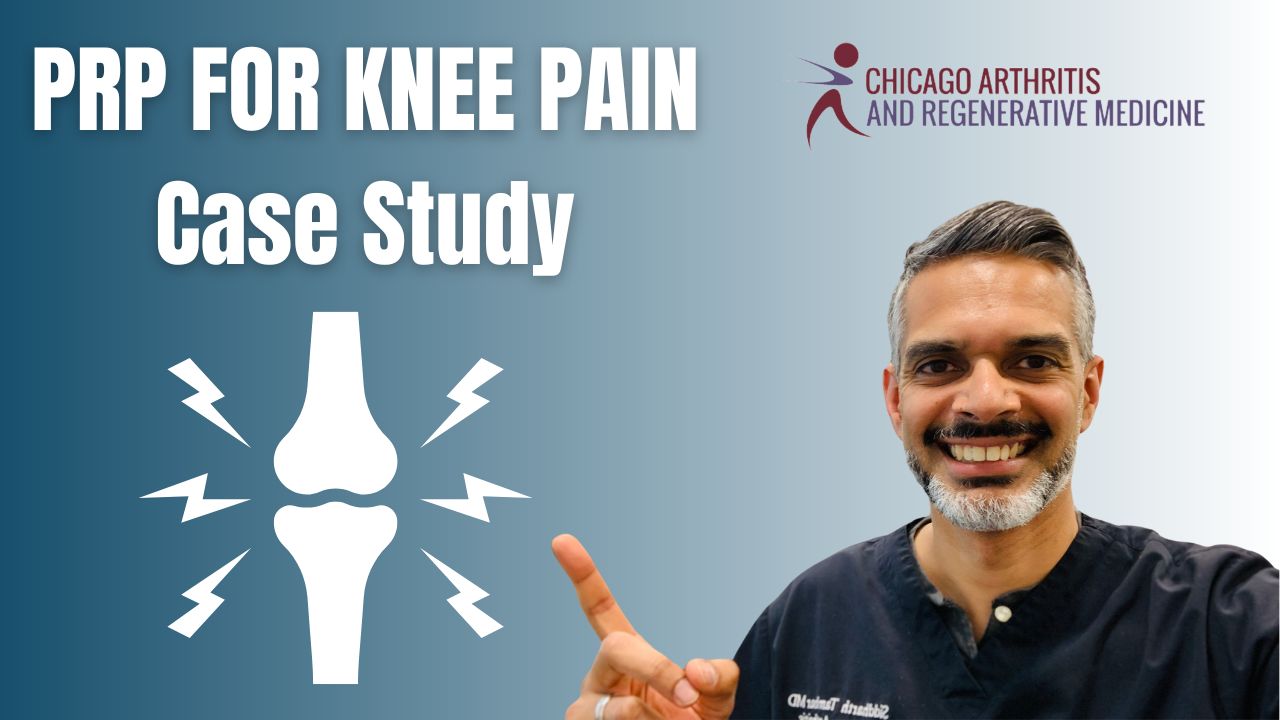 Case Study: Platelet Rich Plasma for Knee Pain