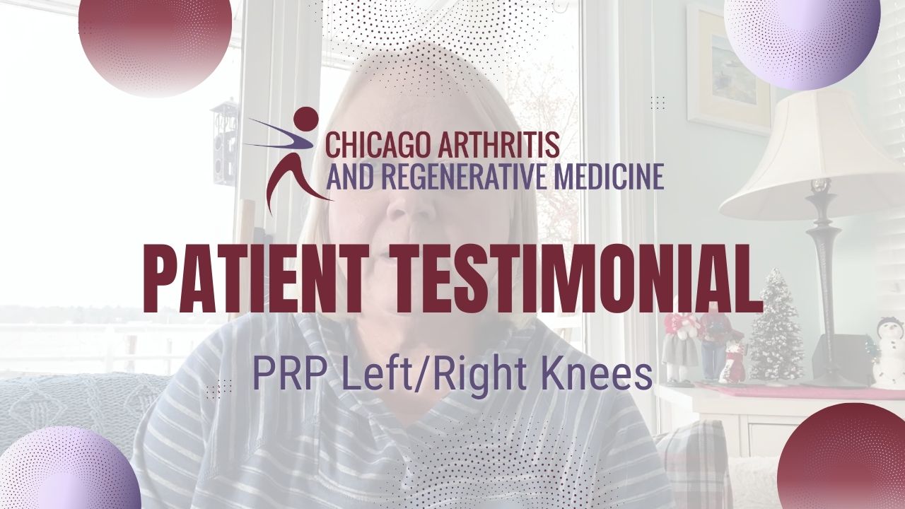 Barbara’s PRP Left/Right Knees | Chicago Arthritis Testimonial