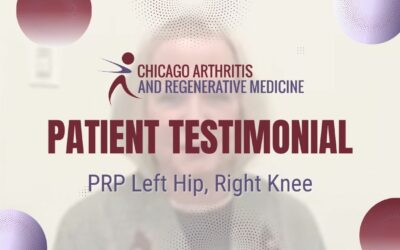 Mary’s PRP Treatment for Left Hip and Right Knee | Chicago Arthritis Testimonial
