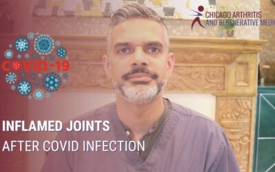 Inflamed Joints After COVID Infection