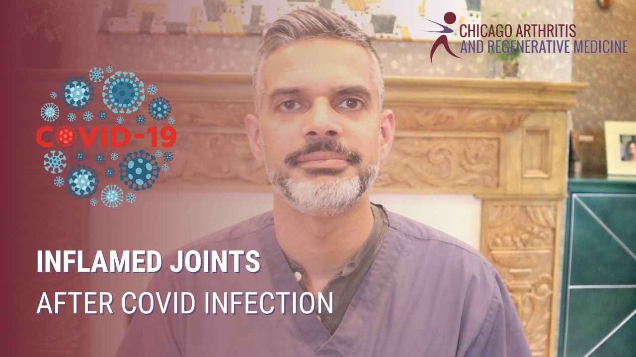Inflamed Joints After COVID Infection