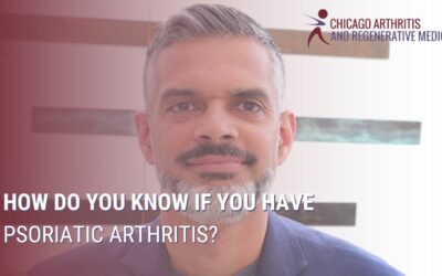 How Do You Know If You Have Psoriatic Arthritis?