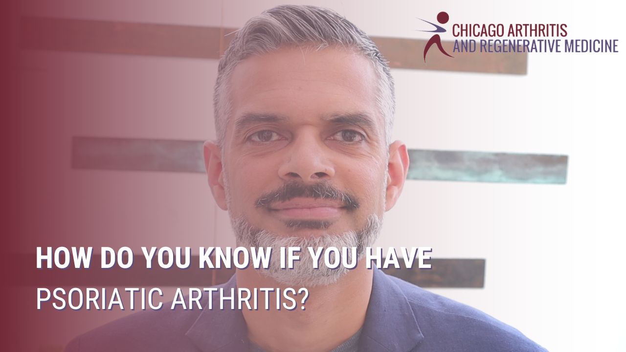 How Do You Know If You Have Psoriatic Arthritis?