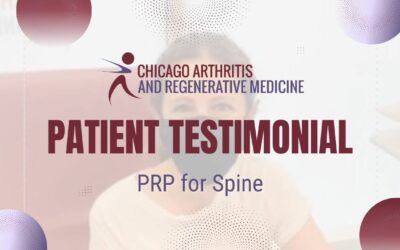 Suzanne’s PRP for Spine | Chicago Arthritis Testimonial