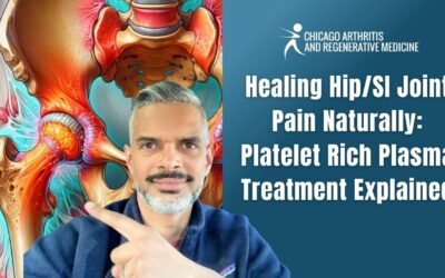 Platelet-Rich Plasma (PRP) for SI Joint and Hip Pain