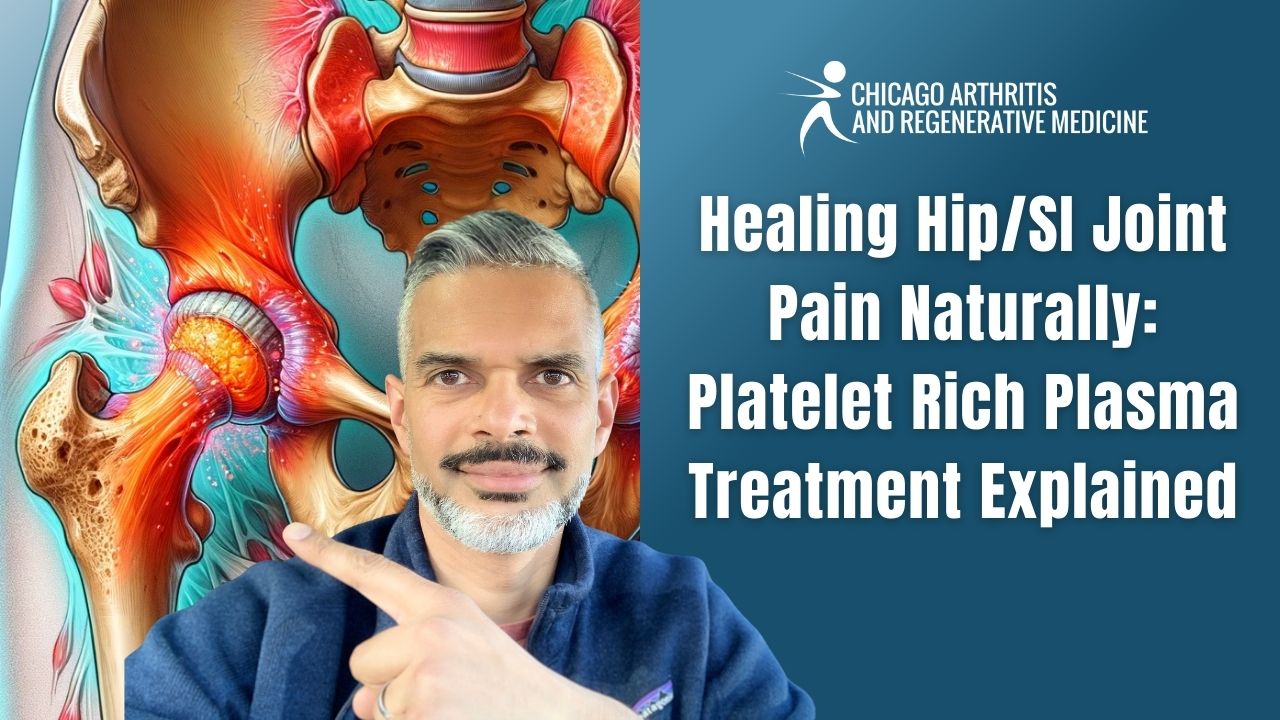 Platelet-Rich Plasma (PRP) for SI Joint and Hip Pain