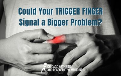 Could Your Trigger Finger Signal a Bigger Problem?