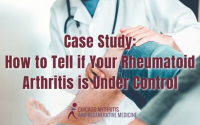 Case Study: How to Tell if Your Rheumatoid Arthritis is Under Control