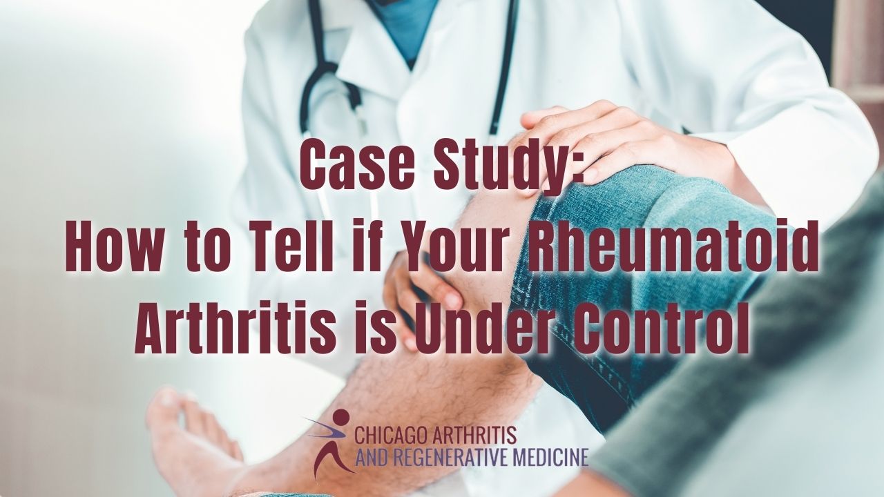 Case Study: How to Tell if Your Rheumatoid Arthritis is Under Control