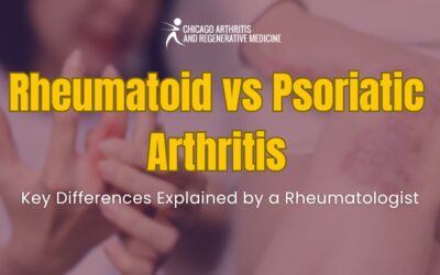 Rheumatoid vs Psoriatic Arthritis: Key Differences Explained by a Rheumatologist