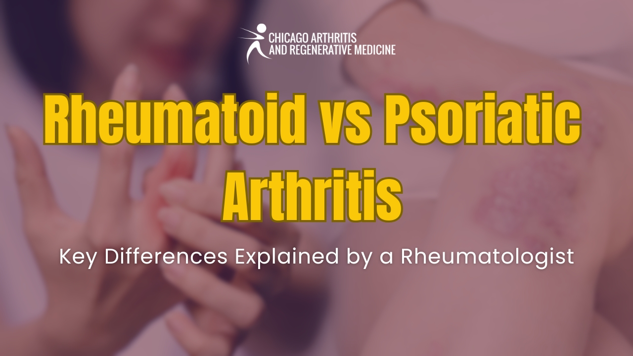 Rheumatoid vs Psoriatic Arthritis: Key Differences Explained by a Rheumatologist