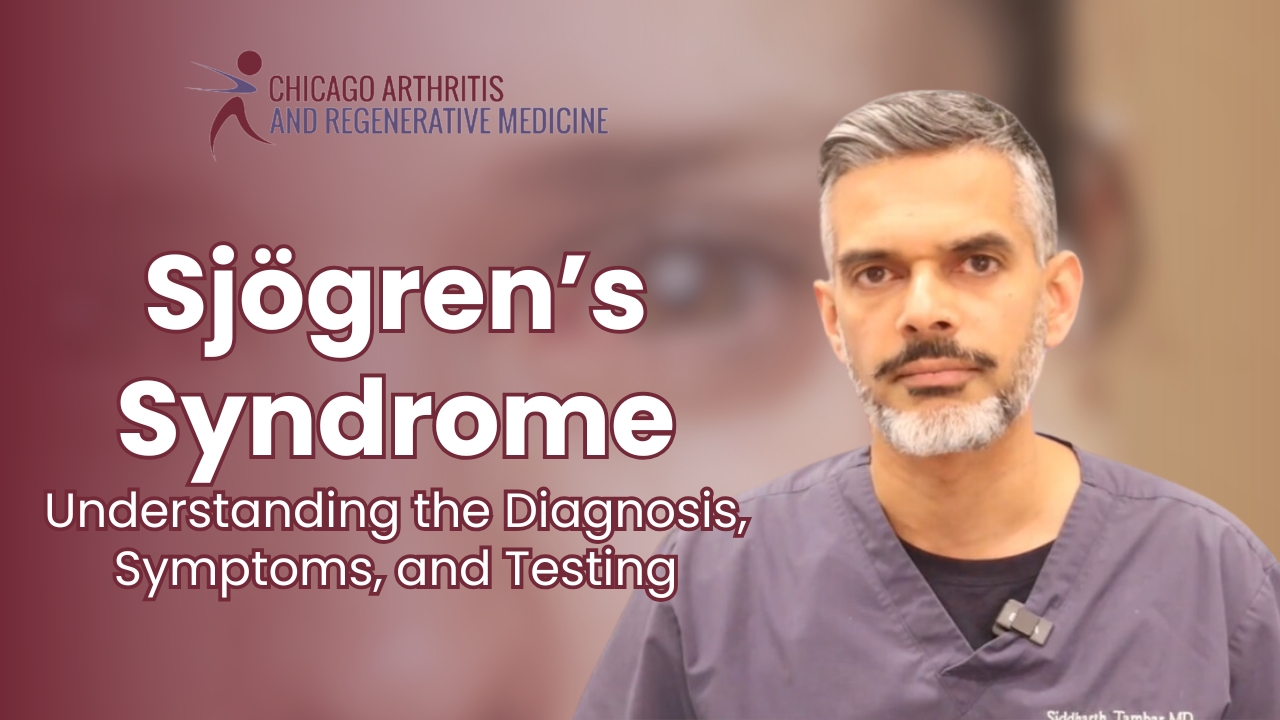 Sjögren’s Syndrome: Understanding the Diagnosis, Symptoms, and Testing