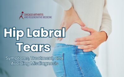 Hip Labral Tears: Symptoms, Treatment, and Avoiding Misdiagnosis