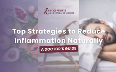 Top Strategies to Reduce Inflammation Naturally A Doctor’s Guide