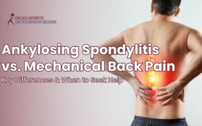 Ankylosing Spondylitis vs. Mechanical Back Pain: Key Differences & When to Seek Help