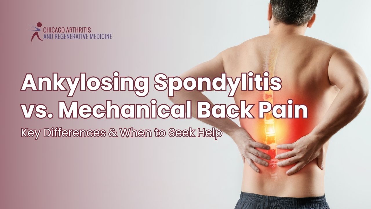 Ankylosing Spondylitis vs. Mechanical Back Pain: Key Differences & When to Seek Help