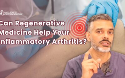 Can Regenerative Medicine Help Manage Inflammatory Arthritis?