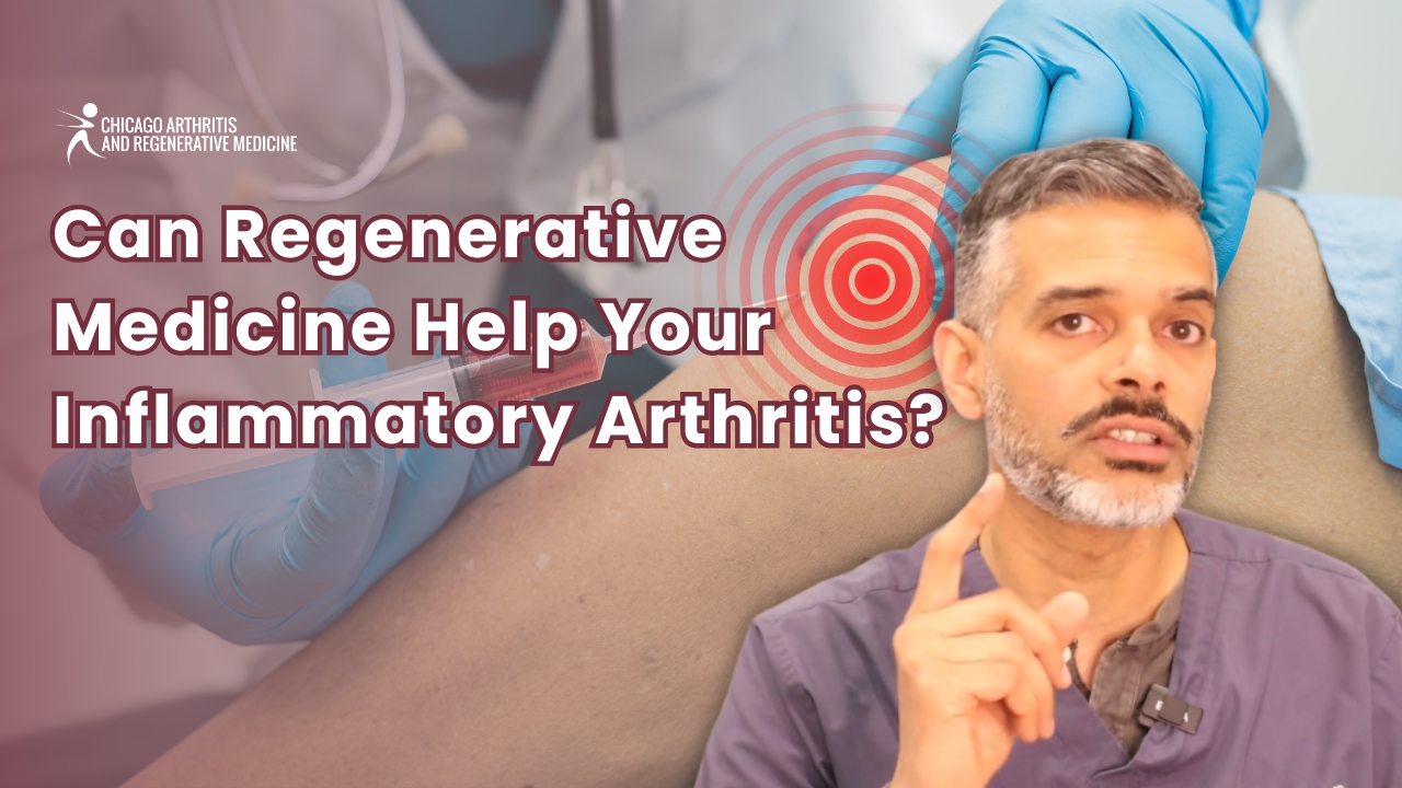 Can Regenerative Medicine Help Manage Inflammatory Arthritis?