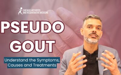 Understanding Pseudogout: Treatment, Causes, and Relief for Joint Pain