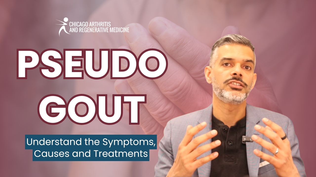 Understanding Pseudogout: Treatment, Causes, and Relief for Joint Pain