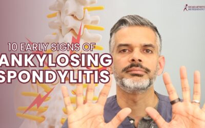 10 Early Signs of Ankylosing Spondylitis You Shouldn’t Ignore!