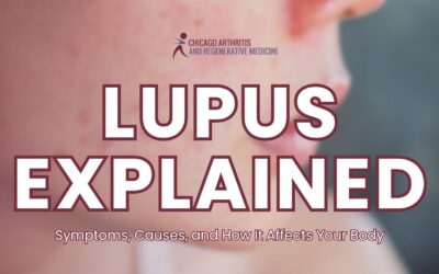 Lupus Explained: Symptoms, Causes, and How It Affects Your Body