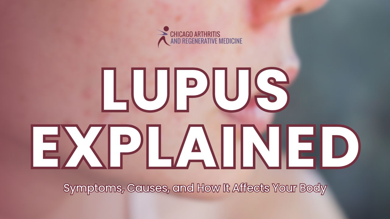 Lupus Explained: Symptoms, Causes, and How It Affects Your Body