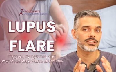 The Lupus Flare Cycle: Triggers, Symptoms, and How to Manage Flares Effectively