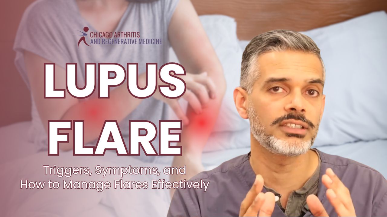 The Lupus Flare Cycle: Triggers, Symptoms, and How to Manage Flares Effectively