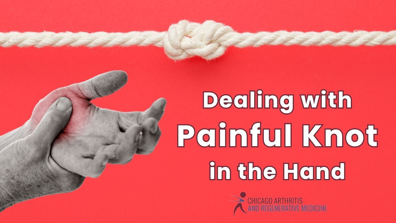 Dealing with a Painful Knot in the Hand