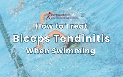 How to Treat Biceps Tendinitis When Swimming Effectively