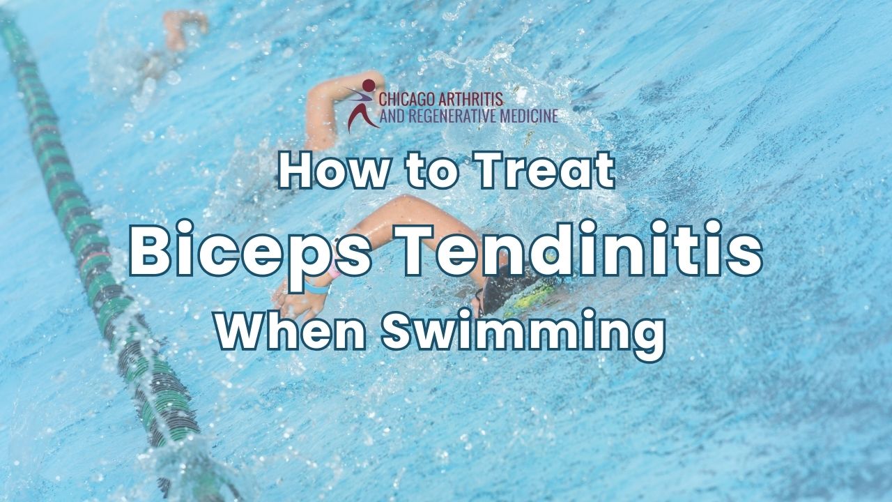 How to Treat Biceps Tendinitis When Swimming Effectively